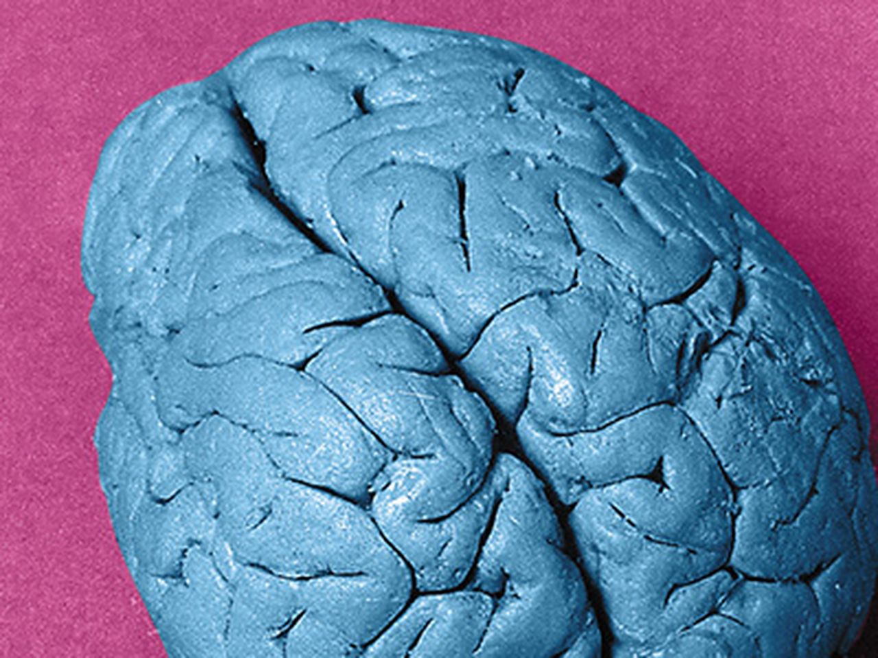 Brain-Teaser-631.jpg