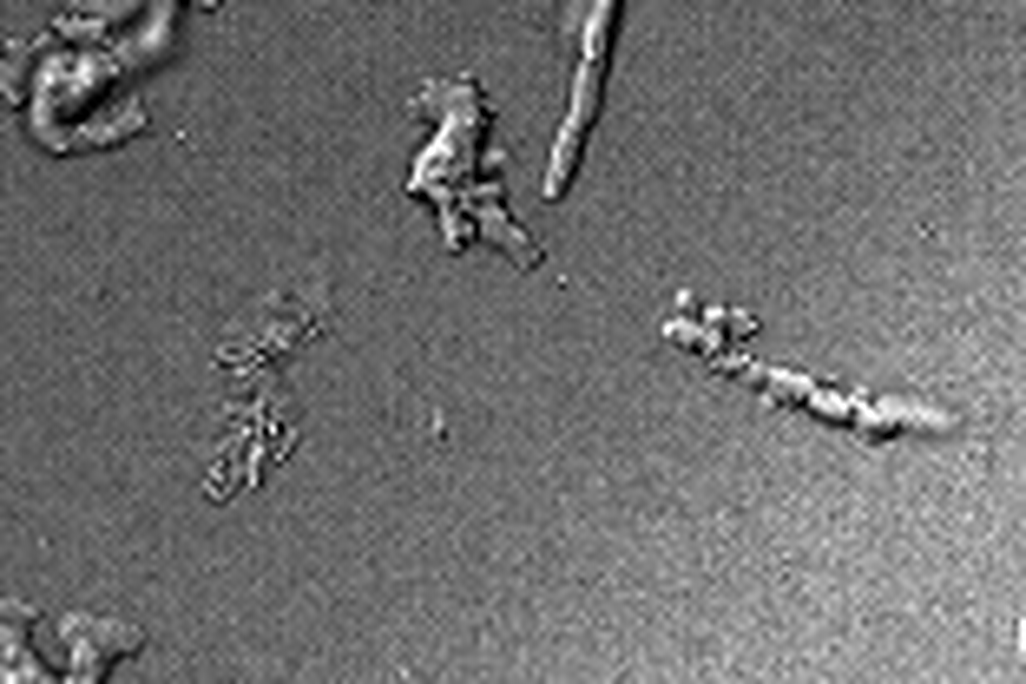 black-and-white blobs moving around