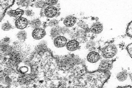 This transmission electron microscopic image shows the pandemic coronavirus SARS-CoV-2. 