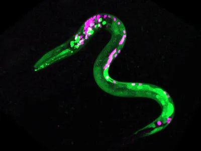 This worm is genetically engineered so some neurons and muscles are fluorescent. Green dots are neurons that respond to cannabinoids, while magenta dots are other neurons.