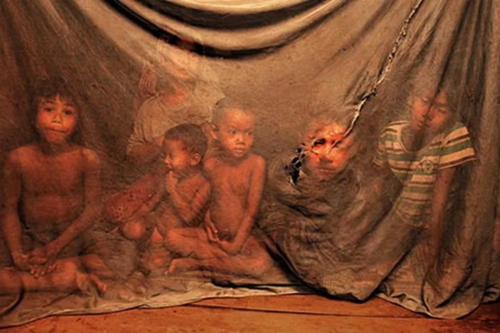Cambodia children with malaria