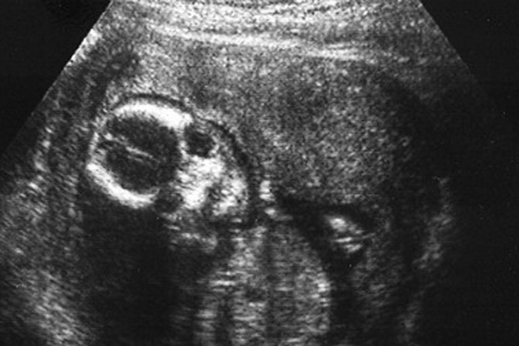 baby-womb-language-470.jpg