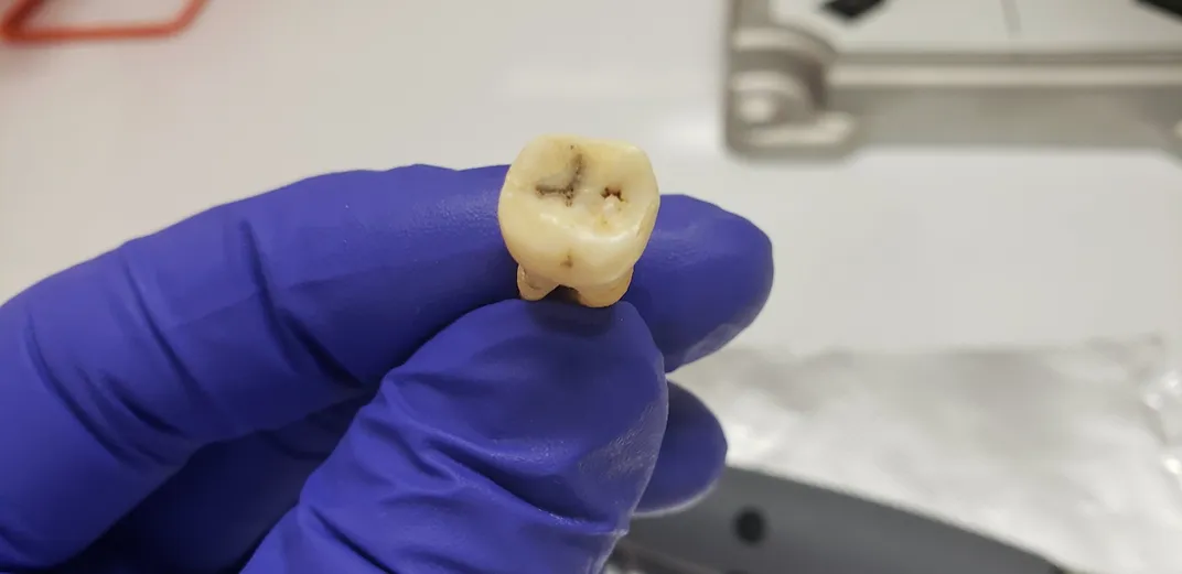 tooth 2