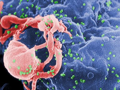 Scientists are using genetic sequencing to reconstruct how AIDS hit the United States in the 1970s and 1980s.