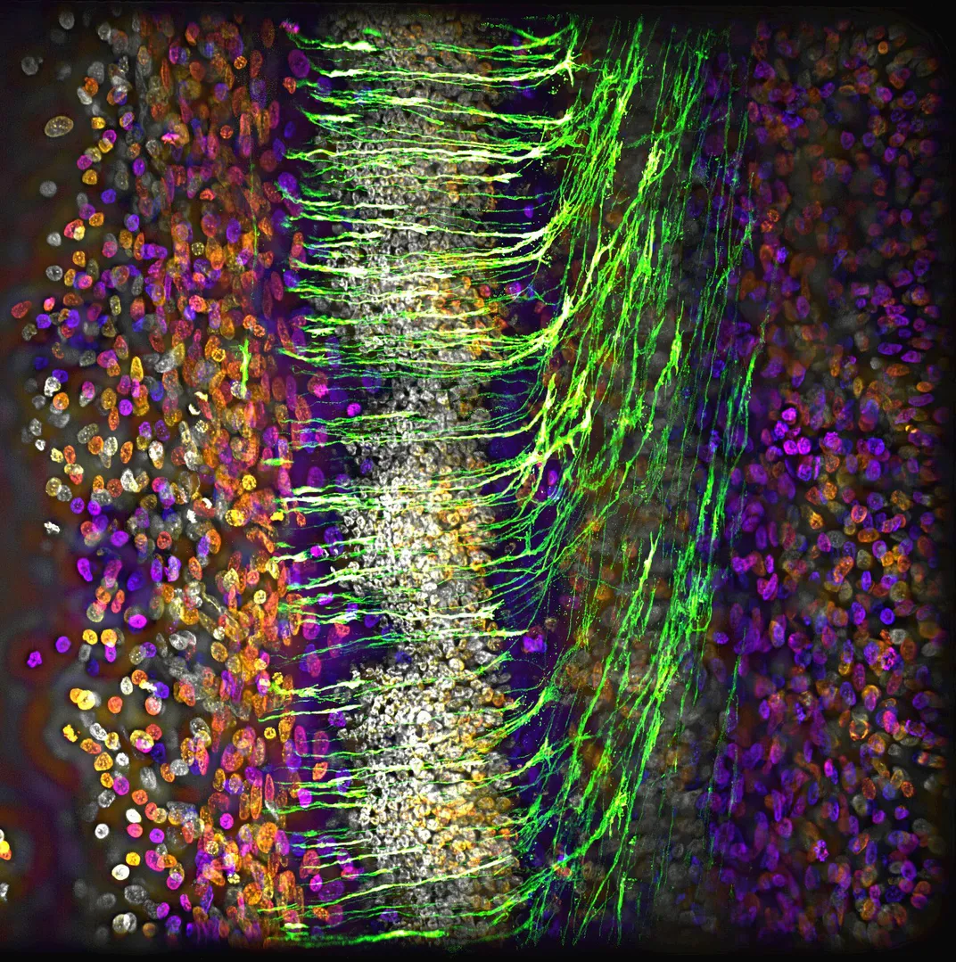 colorful cells on either side connected by green and white tendrils