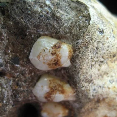 The dental plaque on Australopithecus sediba teeth reveals the species ate wood or bark.