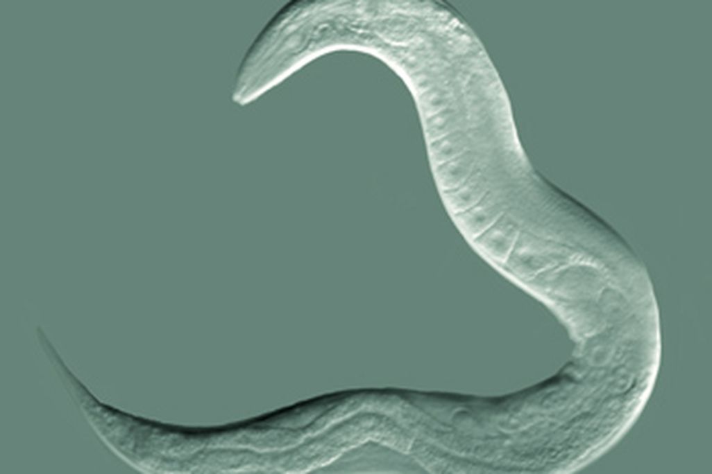 20110520102310CelegansGoldsteinLabUNC.jpg
