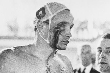 Hungarian water polo player Ervin Zador's eye is injured during the closing minutes of a game against the Soviets.