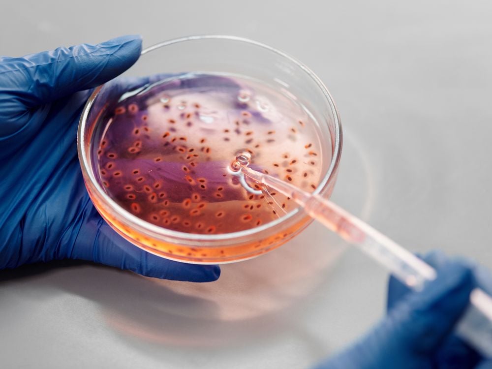 Person's hands holding petri dish