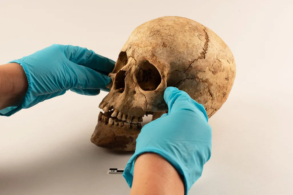 A pair of hands wearing blue gloves touching a human skull