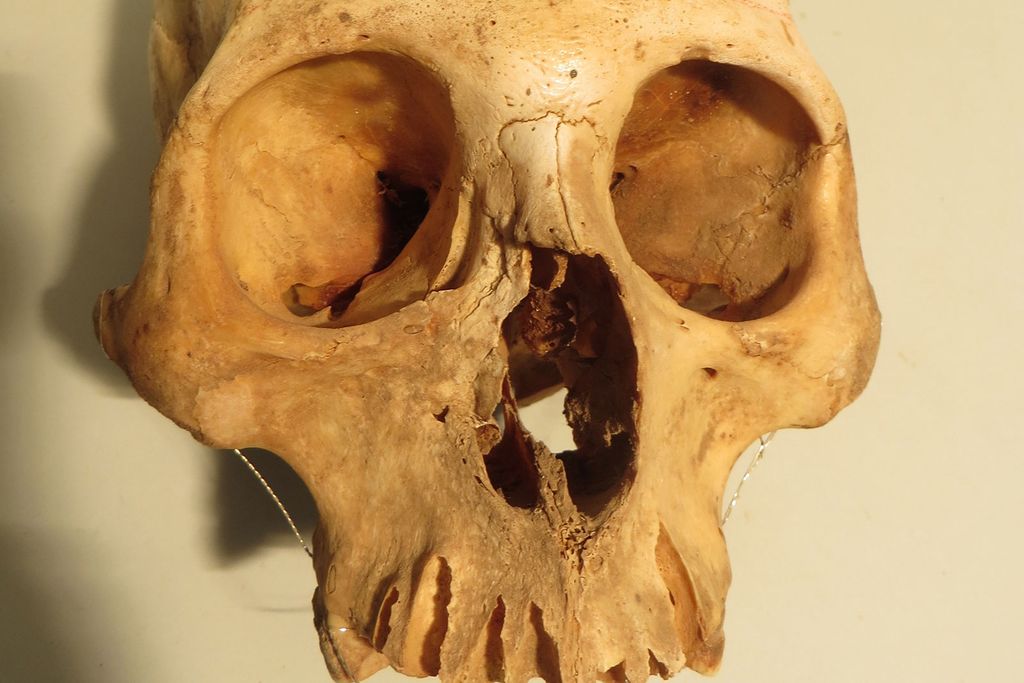 Chilean Skull