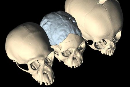 The soft spot and metopic suture are clearly visible on the skull of the young human (right) and absent in the young chimpanzee (left). Those features are present, although harder to see, in the fossil of a young Australopithecus (center).