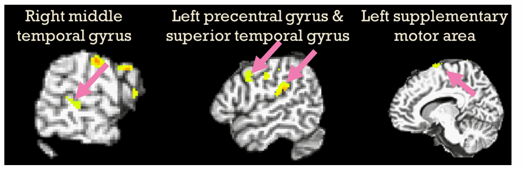 Areas of the brain