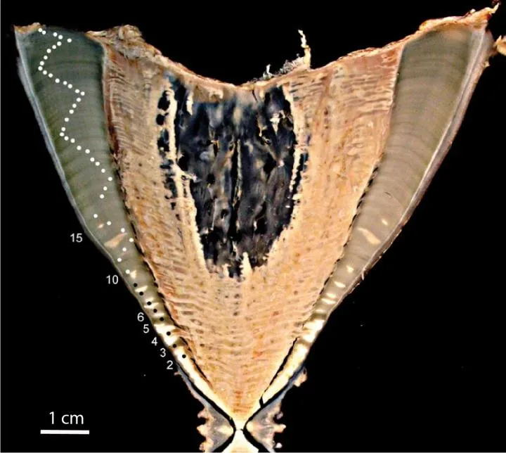 Vertebra