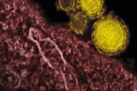 The virus responsible for the Middle East respiratory syndrome.