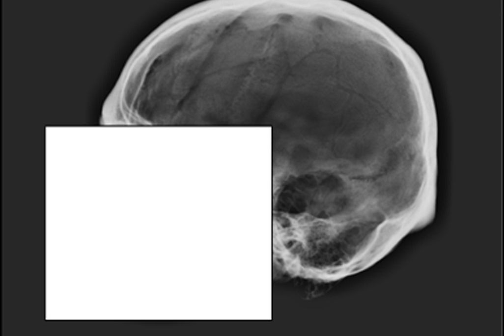Skull release image