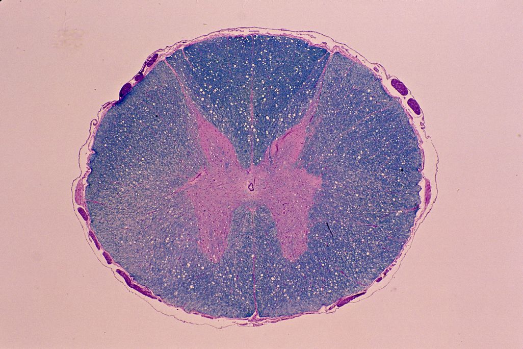 A cross-section of a spinal cord at five times magnification.