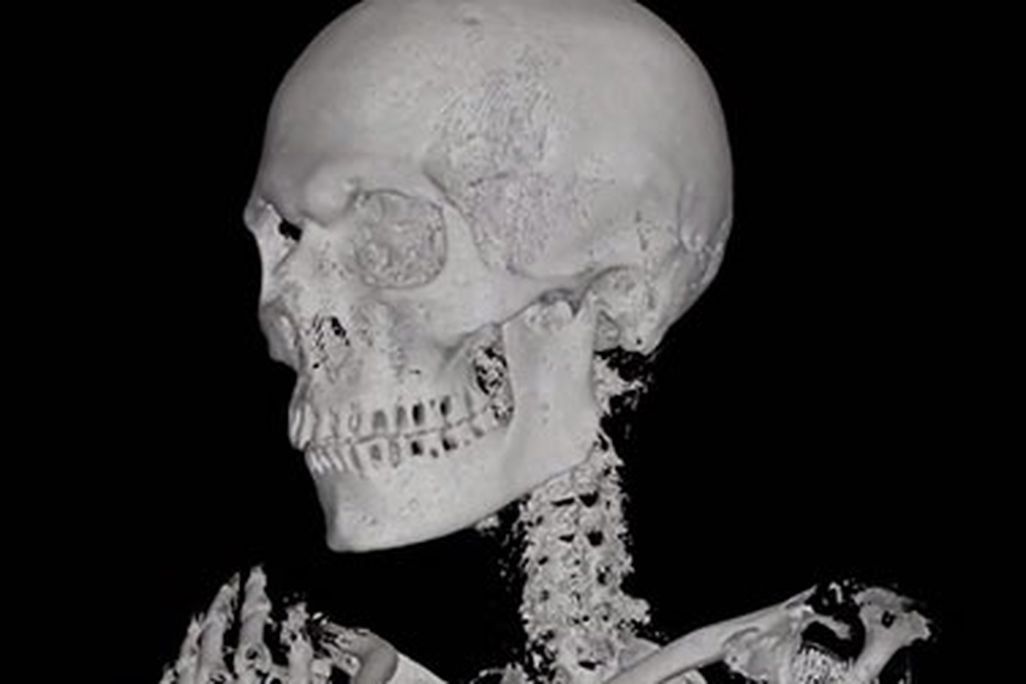 20110913092004ATM-mummy-CT-scan-470.jpg