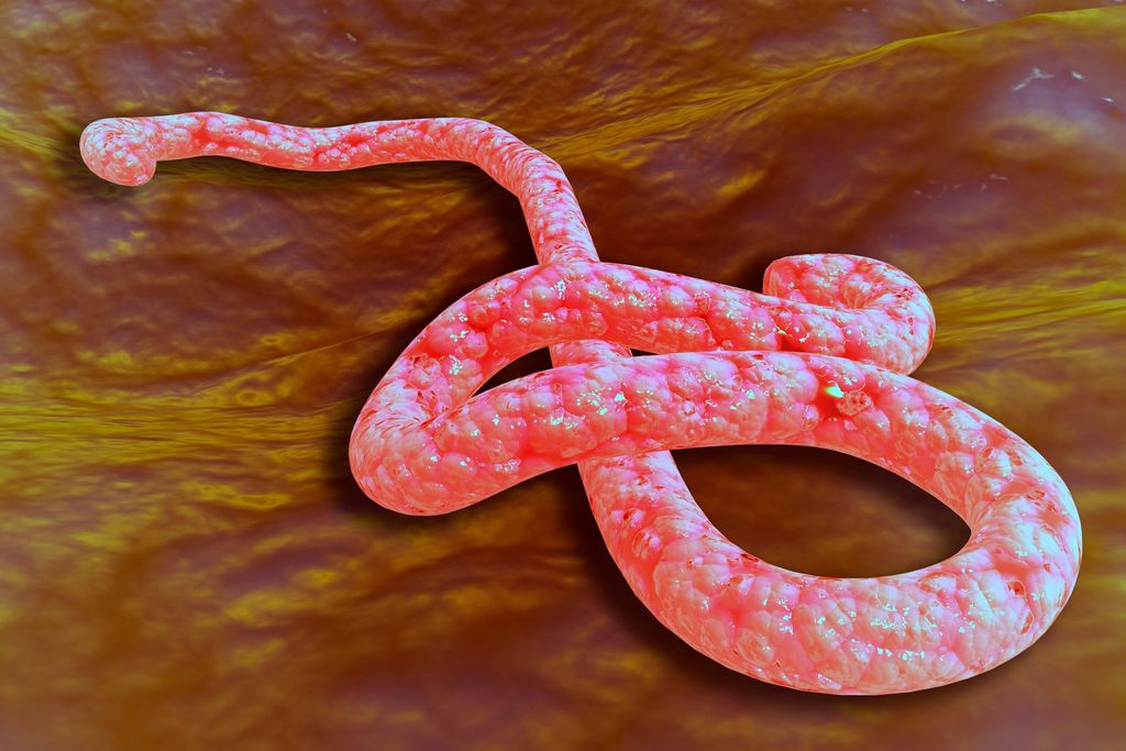 28_11_2014_ebola.jpg
