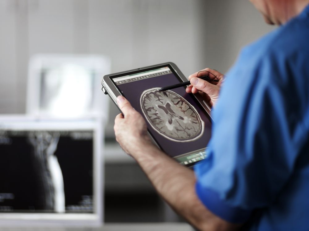 image of a male doctor holding a tablet with an mri scan on it