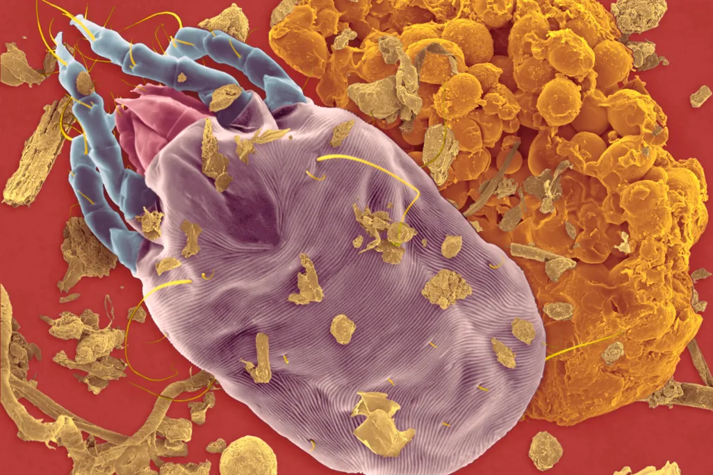 dust mite