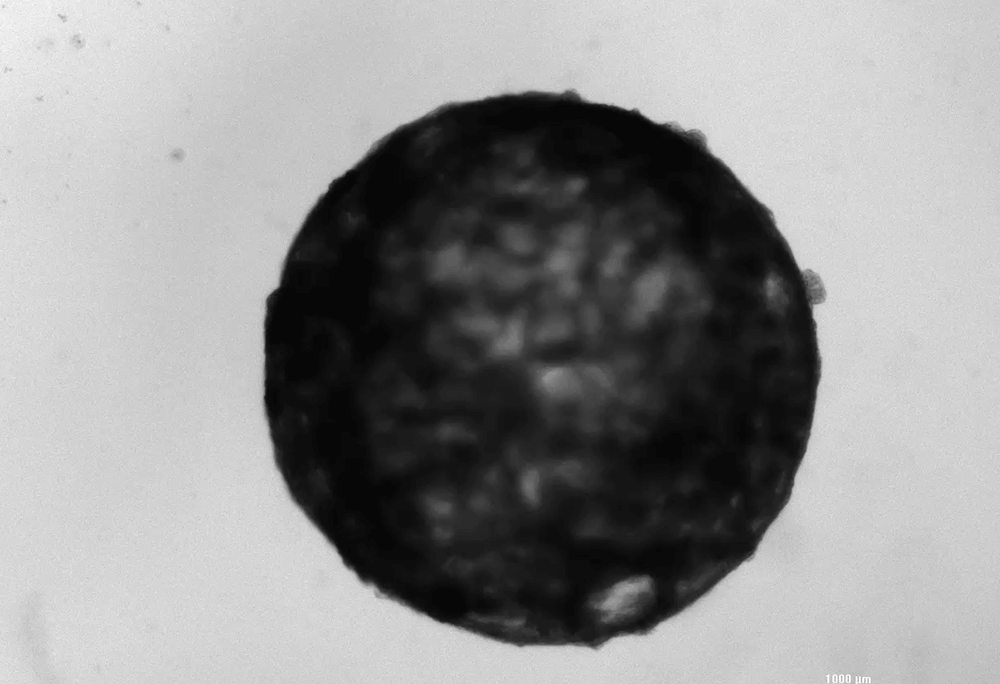 An animated image of a healthy cardioid, which appears dark on a white background, shows the heartbeat 