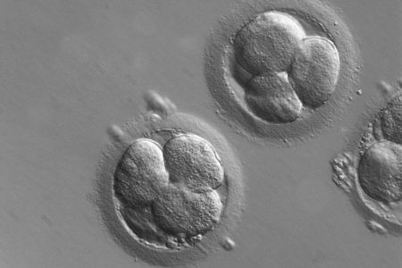 Early stage human embryos
