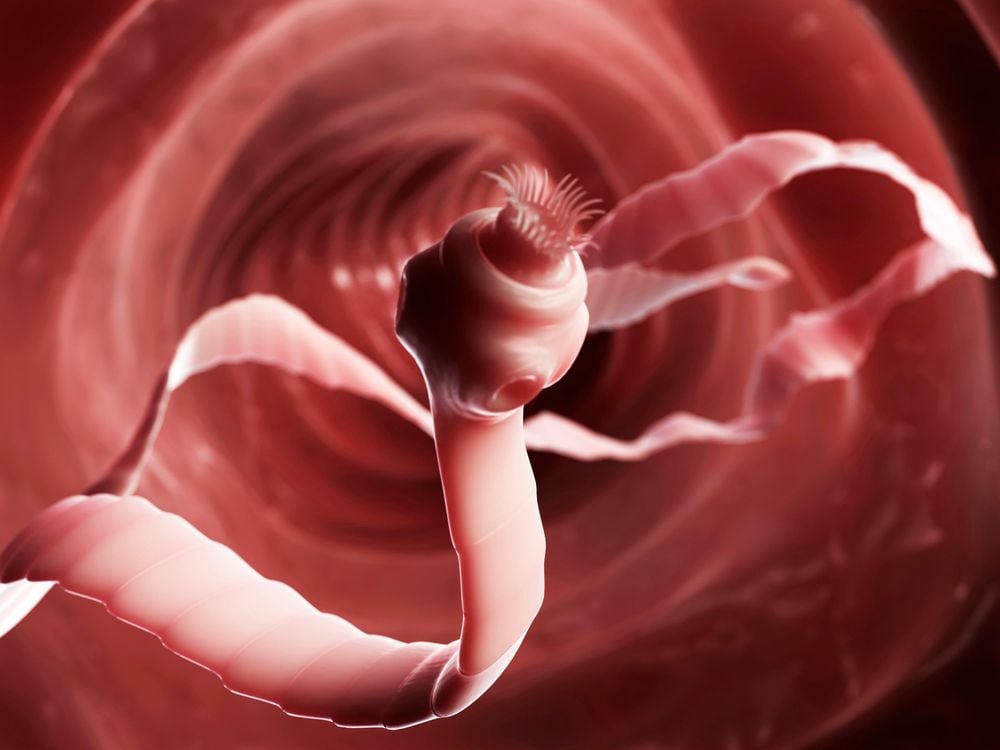 tapeworms in humans