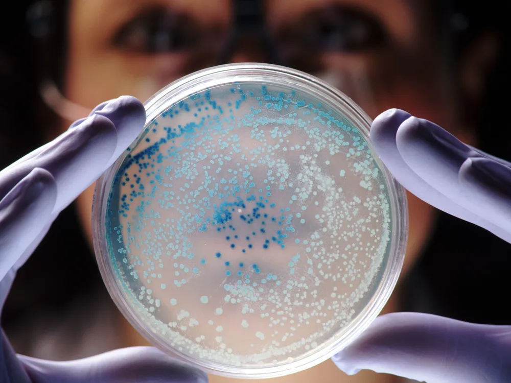E.coli bacteria.jpg