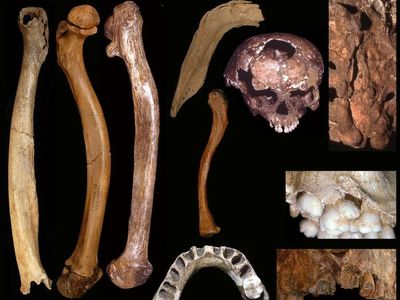 Abnormalities identified included misshapen skulls and jaws, bowed femur and arm bones