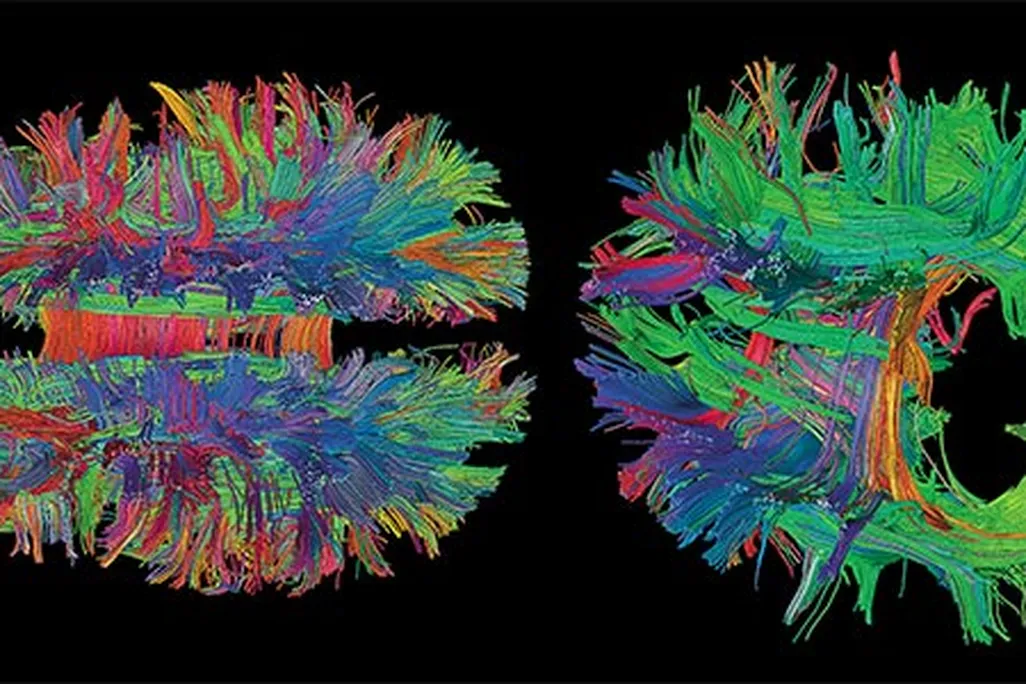 Magnetic resonance imaging