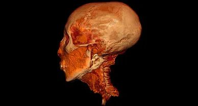 Tut's head, scanned in .62-millimeter slices to register its intricate structures, takes on eerie detail in the resulting image. With Tut's entire body similarly recorded, a team of specialists in radiology, forensics, and anatomy began to probe the secrets that the winged goddess of a gilded burial shrine protected for so long.