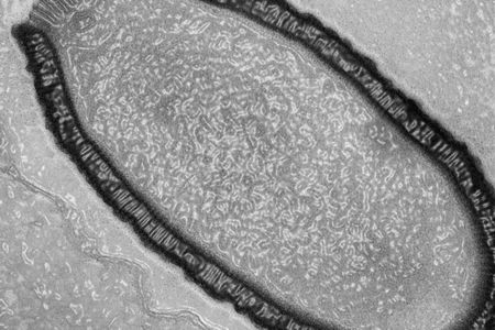 Pithovirus sibericum, TKTK