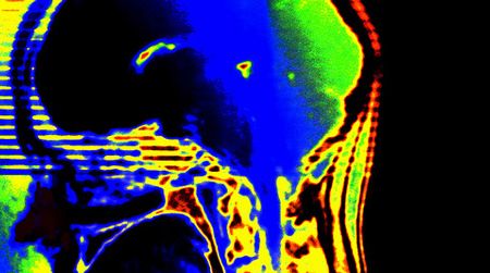 How does free will function in the brain?