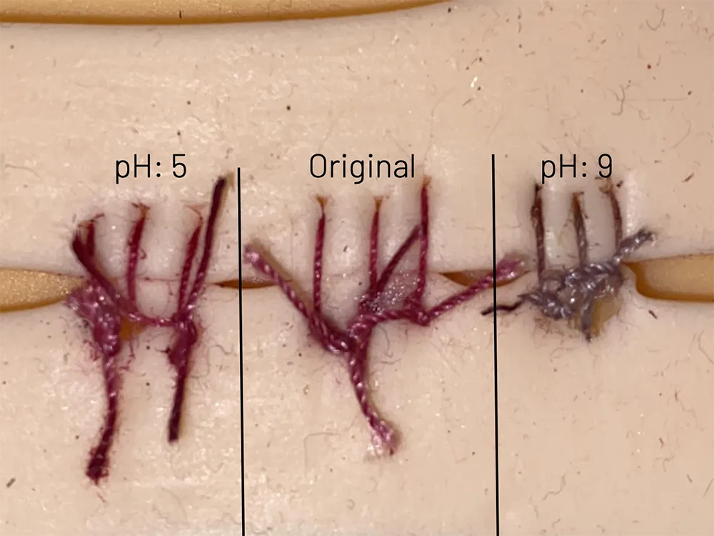 This High Schooler Invented Color-Changing Sutures to Detect Infection