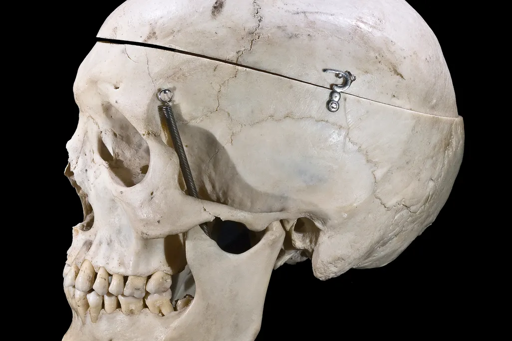 skull