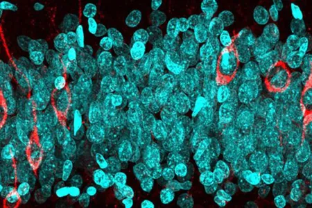Immature (red) and mature (blue) neurons in the hippocampus of a 68 year-old