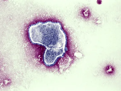 An electron micrograph of the&nbsp;respiratory syncytial virus (RSV), which kills an estimated 160,000 people worldwide each year.