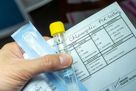 A patient holds a sample test tube for Chlamydia testing.